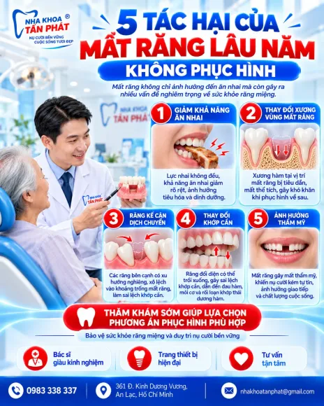 Tin tức