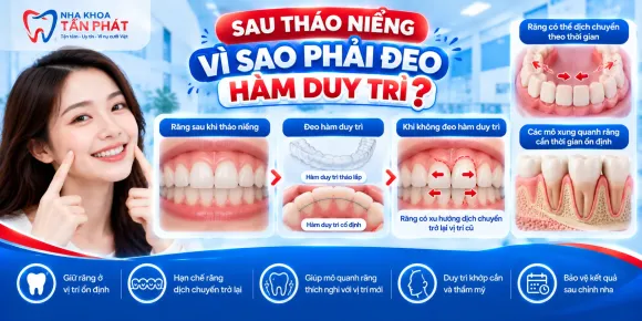 Tại Sao Bắt Buộc Đeo Hàm Duy Trì Sau Khi Tháo Niềng Răng?