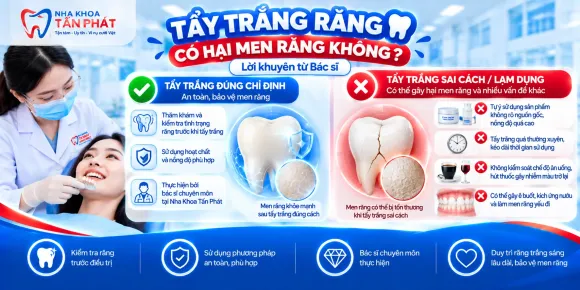 Tẩy Trắng Răng Có Hại Men Răng Không? Lời Khuyên Từ Bác Sĩ