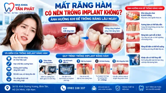 Tin tức