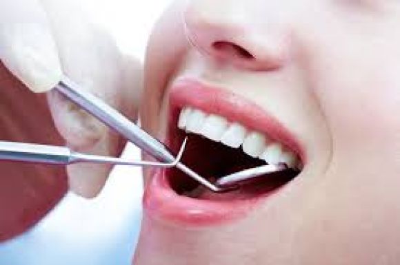 Niềng Răng Trong Suốt Invisalign: Công Nghệ Chỉnh Nha Vô Hình Hiện Đại