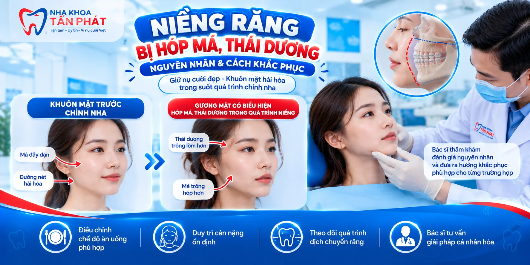 Niềng Răng Bị Hóp Má, Thái Dương: Nguyên Nhân & Cách Khắc Phục