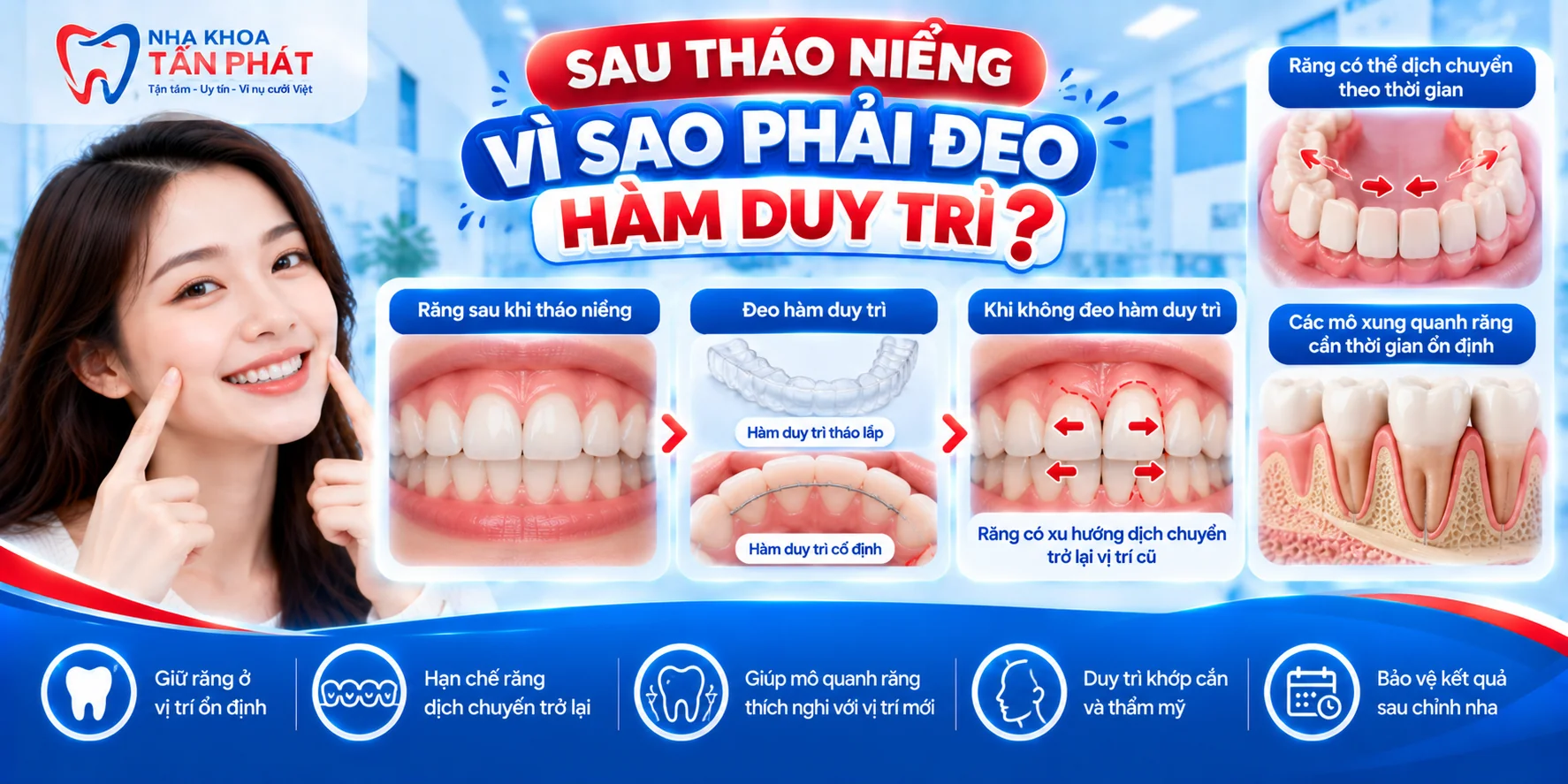 Tại Sao Bắt Buộc Đeo Hàm Duy Trì Sau Khi Tháo Niềng Răng?